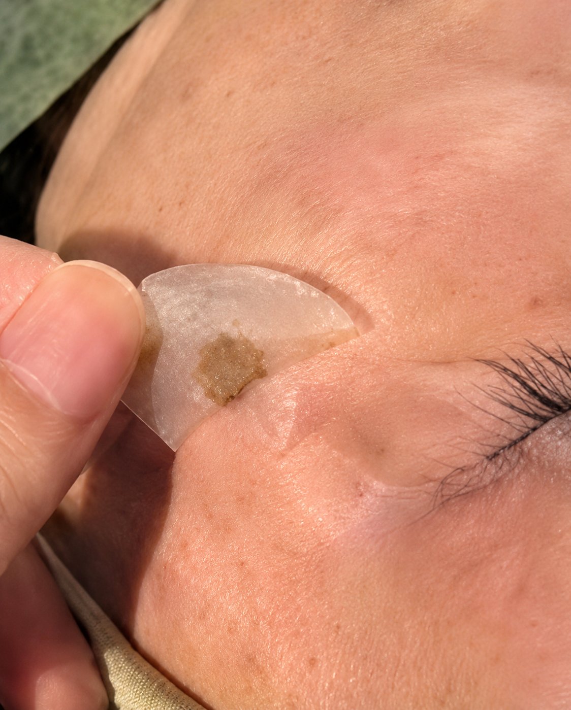NEWTON施術後の剥離のイメージ